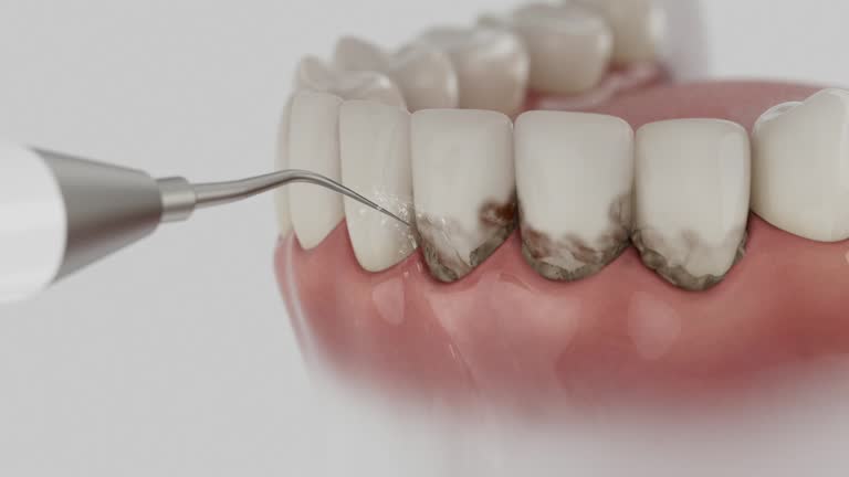 Trusted Tooth Extraction service in Jefferson, OH - Dentist Open Now